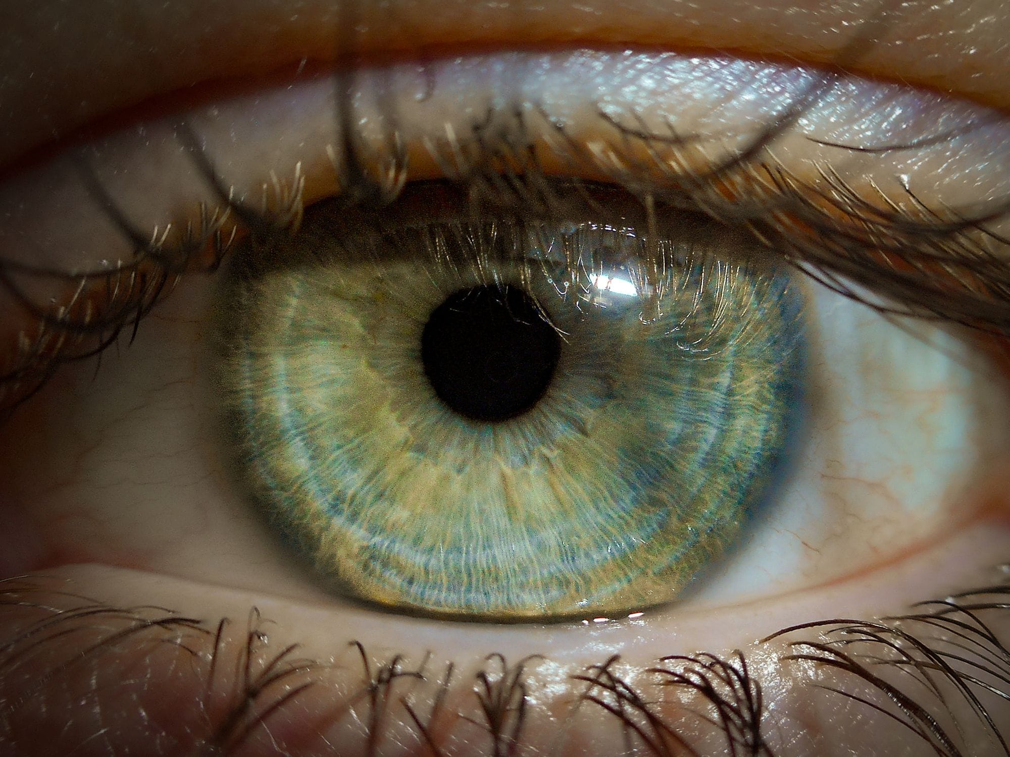 Cornea Care in Hanover, PA