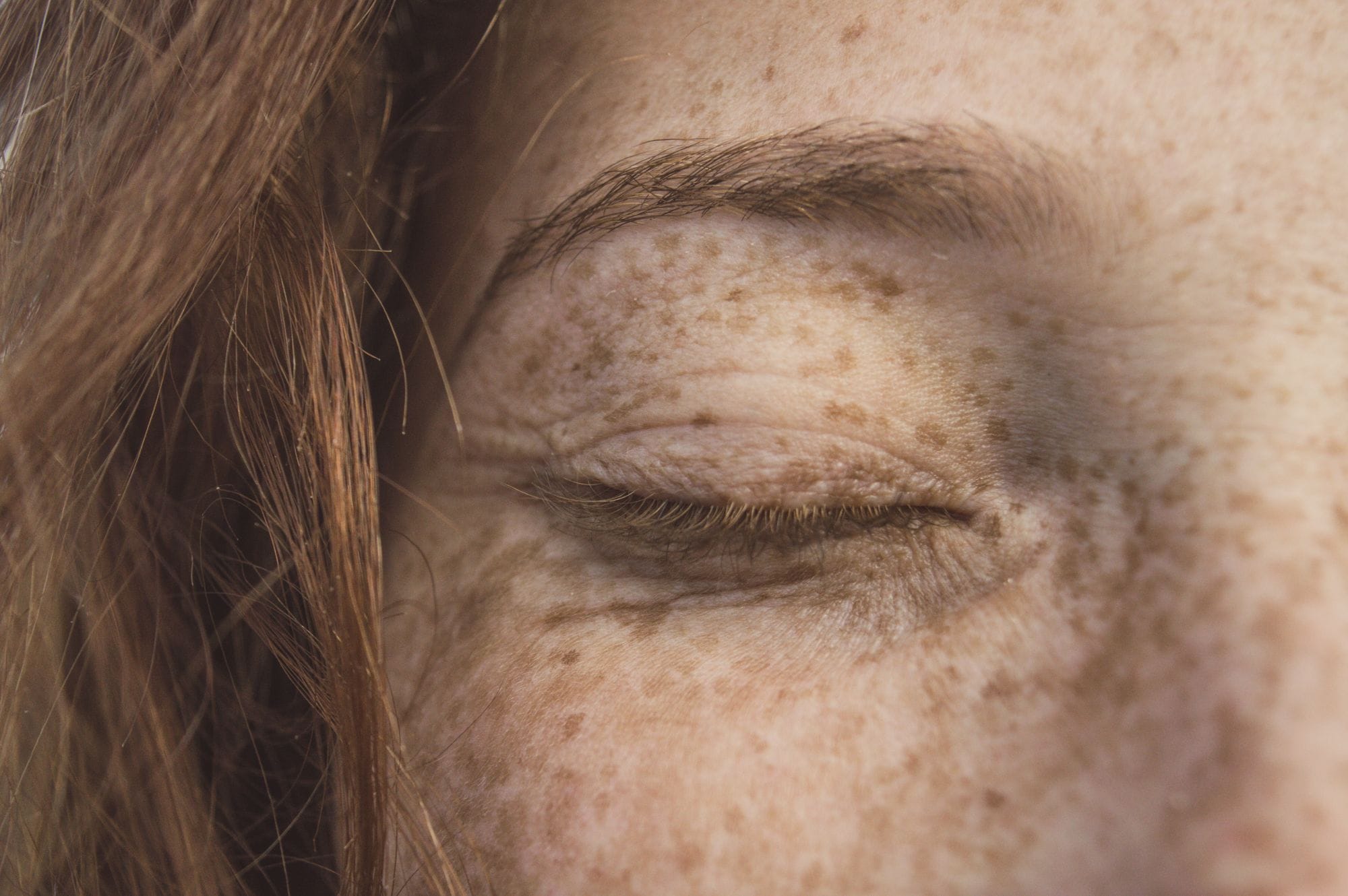 Eyelid & Tearing Problems in Hanover, PA