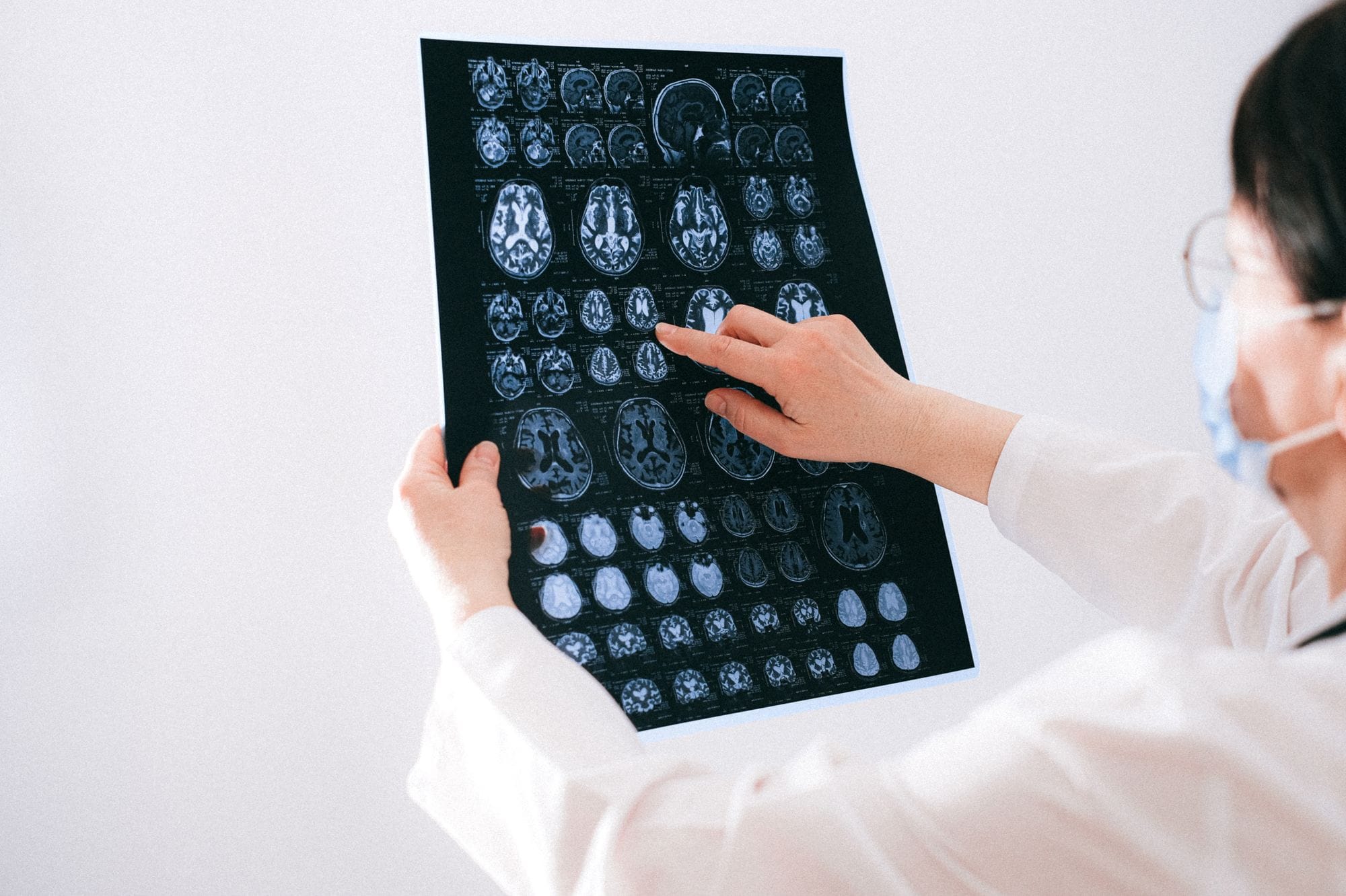 Neuro-Ophthalmology Questions, Answered — Hanover, PA
